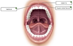 25-12. Correctly label the following anatomical features of the oral cavity.