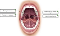 25-13. Correctly label the following anatomical features of the oral cavity.