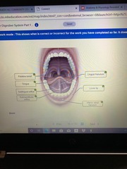 25-14. Correctly label the following anatomical features of the oral cavity.