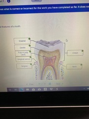 25-19. Correctly label the anatomical features of a tooth.