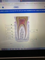 25-20. Correctly label the anatomical features of a tooth.