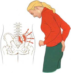 A fall or an improperly delivered gluteal injection could result in ________.
Select one:
a. postpoliomyelitis muscular atrophy
b. neurofibromatosis
c. paresthesia
d. sciatica