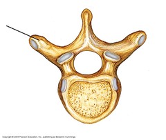 A lateral projection of a vertebra.