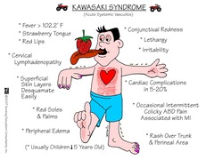 Acute phase of Kawasakis