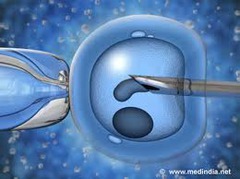 Artificial Insemination performed via intrauterine is reported using?