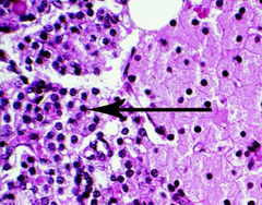 Chief Cells (Parathyroid gland Histological View)