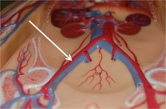 common iliac artery