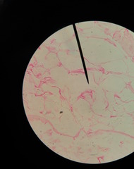 Connective tissue - adipose (fat)

(Note: Cells/nuclei pushed to side.)