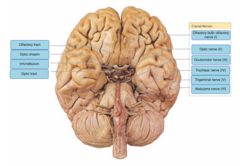 Drag the labels onto the diagram to identify the origins of the cranial nerves (I - VI).