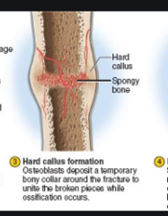 During the healing of a bone fracture, what bone cell produces a HARD CALLUS?