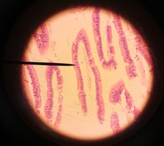 Epithelial tissue - columnar cells with pointer pointed at VILLUS

 (Note: Columnar cells absorb nutrients from food and give to blood.)