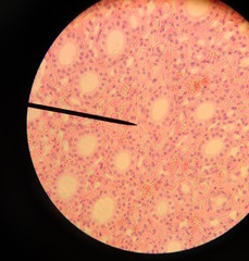 Epithelial tissue - cuboidal cells

 (Note: Cuboidal cells reabsorb of nutrients to put back into blood.)