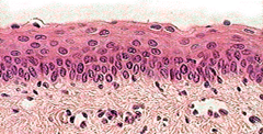 Epithelial tissue - stratified (layered) squamous cells 

(Note: Stratified cells occur at abrasions and on the skin because layers protect body.)