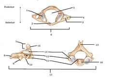 Facet that articulates with occipital condyle