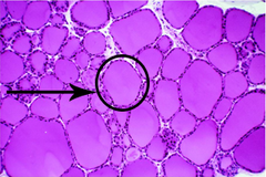 Follicle (Thyroid Histological View)