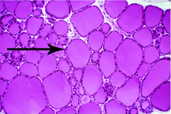 Follicular cell (Thyroid Histological View)