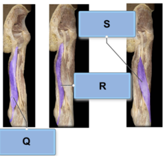 Hamstring muscles: Identify the correct insertions or origins for the muscles labelled as Q, R, & S