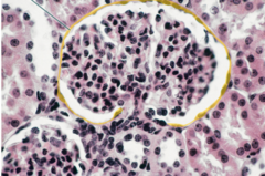 Highlighted epithelium is simple squamous epithelium