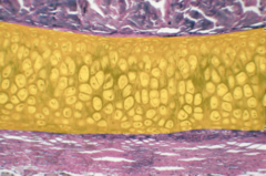 Highlighted region is elastic cartilage.