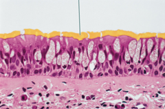 Highlighted structure is cilia.