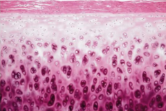 Highlighted tissue is hyaline cartilage.