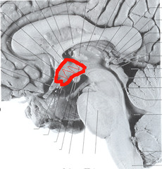 hypothalamus