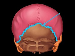 Identify the large suture on the posterior surface of the skull at the border of the occipital bone.