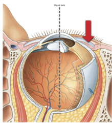 Identify the structure of the eye at the end of the red arrow.