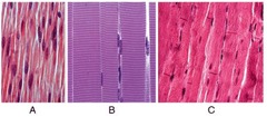 In the figure shown, which light micrograph shows a muscle tissue that is under involuntary control?