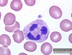 Is the highlighted cell a granulocyte or is it an agranulocyte?