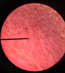 Muscle tissue - cardiac 

(Note: Striated; Has intercalated discs that allow for communication between cardiac muscle cells.)
