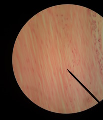 Muscle tissue - smooth 
(Note: NOT striated; Found in esophagus, intestine, stomach and smooth because it allows food to push through.)