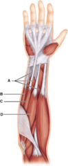 Muscles A through D all have an origin in common-- what is it?

radial tuberosity 

lateral aspect of the proximal ulna 

medial epicondyle of humerus 

lateral epicondyle of humerus