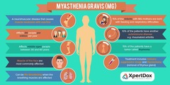 Myasthenia gravis care (with attention to improving nutrition)