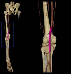 Name the highlighted artery above the knee.