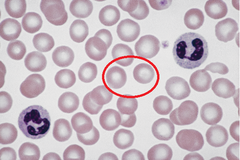 Name the molecule in the red blood cell that carries oxygen
