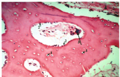 Osteocyte (inside lacunae); Trabeculae
