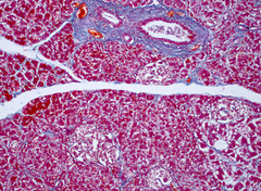 Pancreas (Histological View 100x)