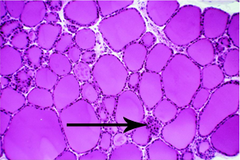 Parafollicular cells (Thyroid Histological View)