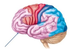 Prefrontal cortex (frontal lobe)