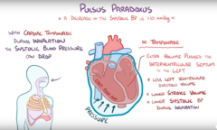 Pulse paradoxus