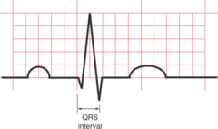 QRS interval