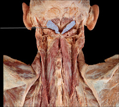 rectus capitis posterior major