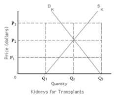 Refer to Exhibit 4-5. Suppose the government imposes a price ceiling at P = $0 for transplanted kidneys. The result will be a