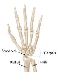 SCAPHOID is an example of what type of bone?