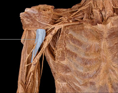 Scapula
Muscle: Coracobrachialis