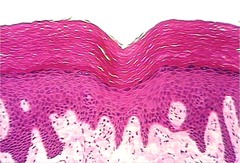 Stratified Squamous (Skin)