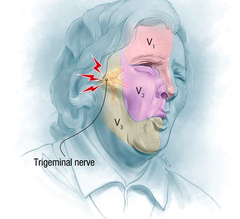 The ________ nerve is not a branch of the trigeminal nerve.
Select one:
a. maxillary
b. ophthalmic
c. mandibular
d. cervical
