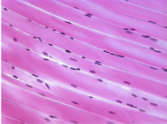 *The answer is E.* This image shows skeletal muscle, which is a striated muscle with peripheral nuclei. The image is stained with hematocylin and eosin.