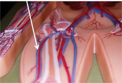 The femoral artery is a continuation of what artery?